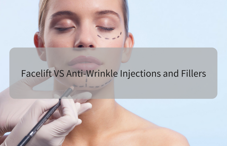 Facelift VS Anti-Wrinkle Injections and Fillers